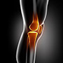 Multiligament Reconstruction of The Knee