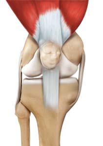 Arthroscopic Reconstruction of the Knee for Ligament Injuries