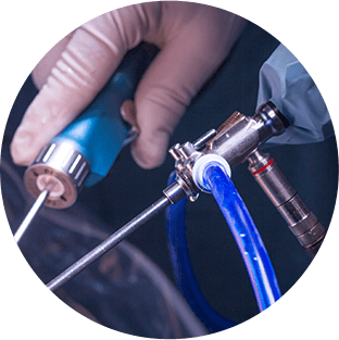 Arthroscopic Surgery